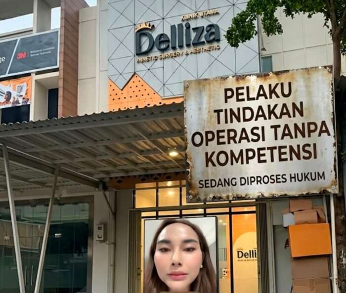 Direskrimsus Polda Metro Jaya Kena “Ghosting” TikTokers: Panggilan Polisi Kalah Pamor dari Live Ipan & Owner Klinik Deliza!