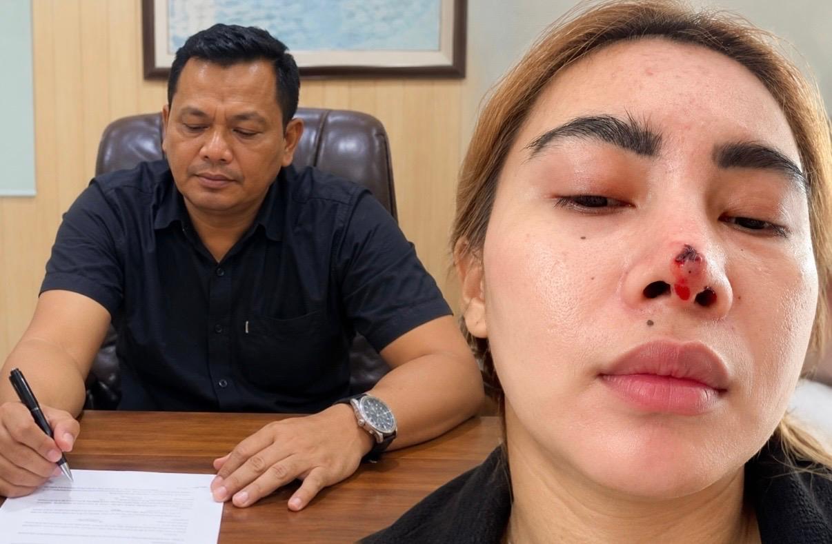 Jhon Saud Damanik Layangkan Surat ke Irwasum dan Kadiv Propam, Minta Usut Tuntas Kasus Klinik Dermakeys